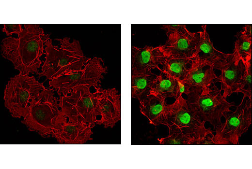 Immunofluorescence Image 1: Phospho-p38 MAPK (Thr180/Tyr182) (D3F9) XP® Rabbit mAb