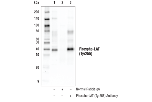 Immunoprecipitation Image 1: Phospho-LAT (Tyr255) Antibody
