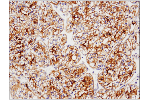 Immunohistochemistry Image 1: TIM-3 (D5D5R™) XP® Rabbit mAb