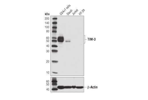 Galectin-9 (D9R4A) XP® Rabbit mAb | Cell Signaling Technology