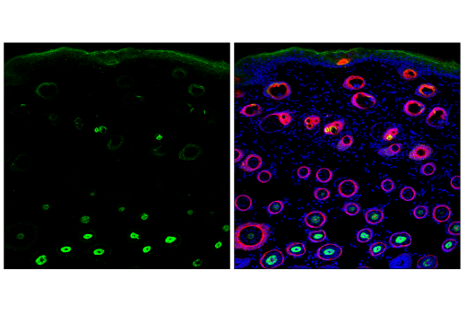 Immunofluorescence Image 1: Pan-Keratin (C11) Mouse mAb (Alexa Fluor® 488 Conjugate)