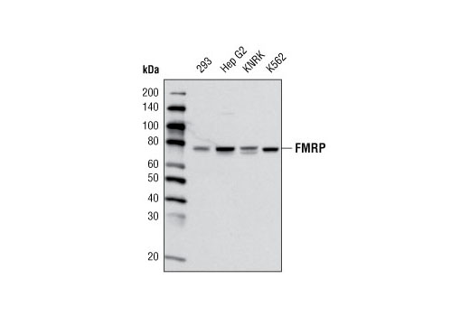 Western Blotting Image 1: FMRP (G468) Antibody