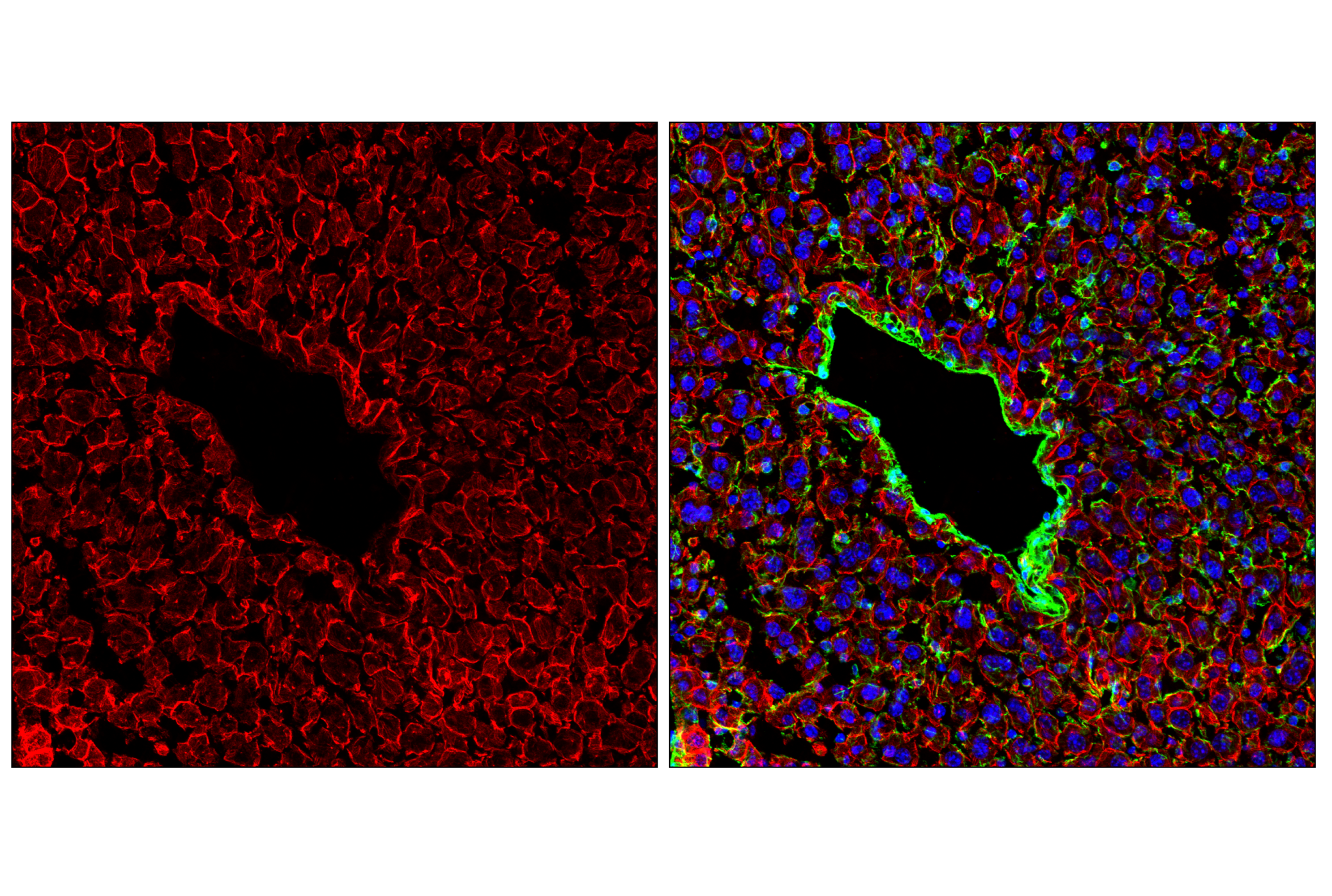 Immunofluorescence Image 1: Pan-Keratin (C11) Mouse mAb (Alexa Fluor® 647 Conjugate)