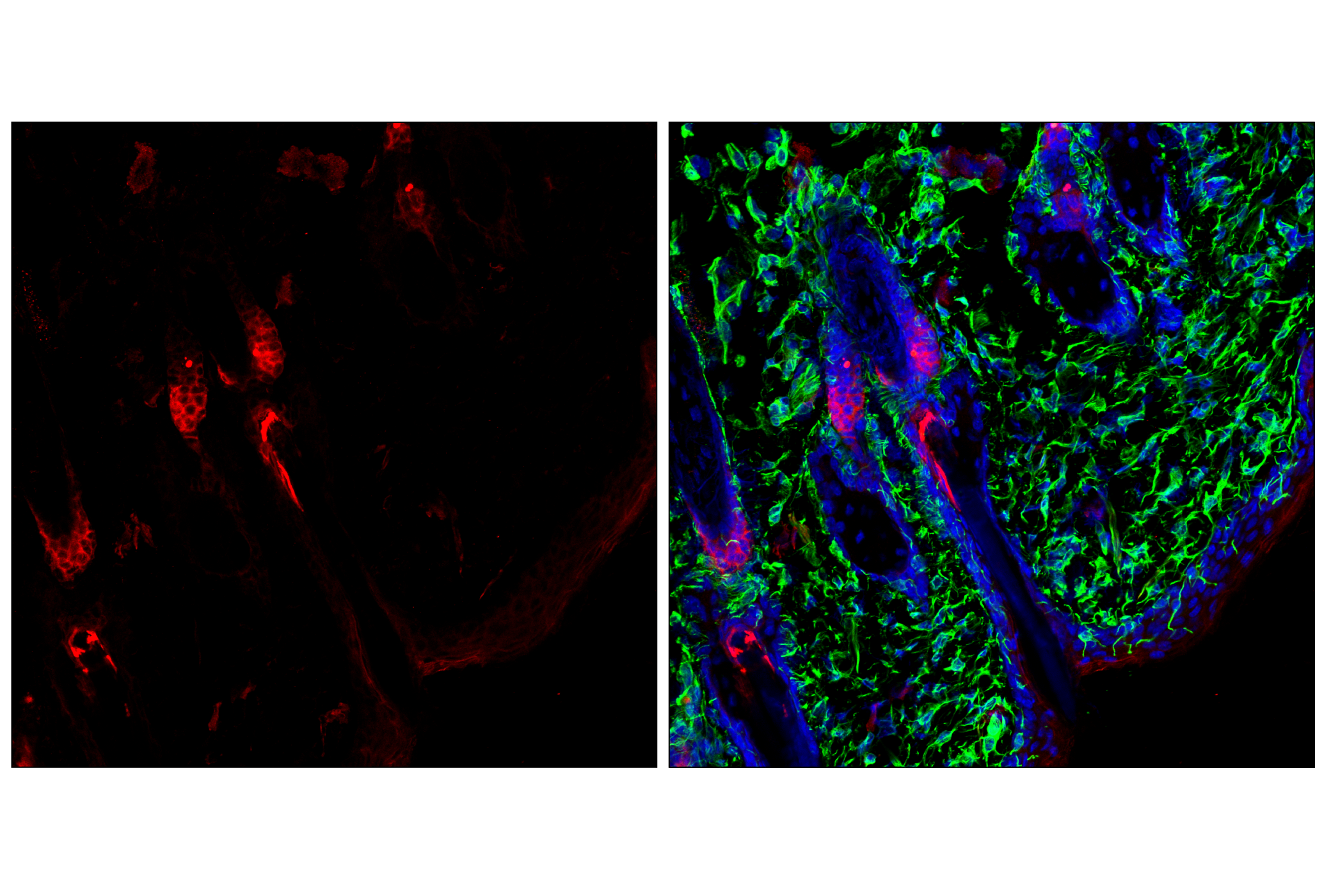 Immunofluorescence Image 2: Pan-Keratin (C11) Mouse mAb (Alexa Fluor® 647 Conjugate)