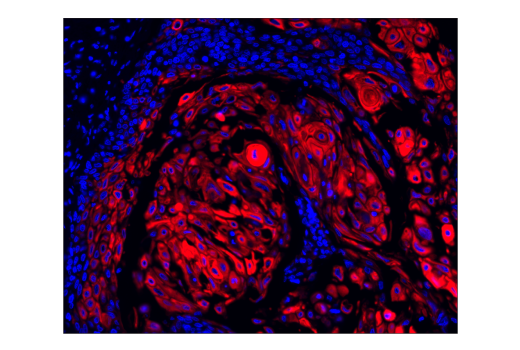 Immunohistochemistry Image 1: Pan-Keratin (C11) Mouse mAb (Alexa Fluor® 647 Conjugate)