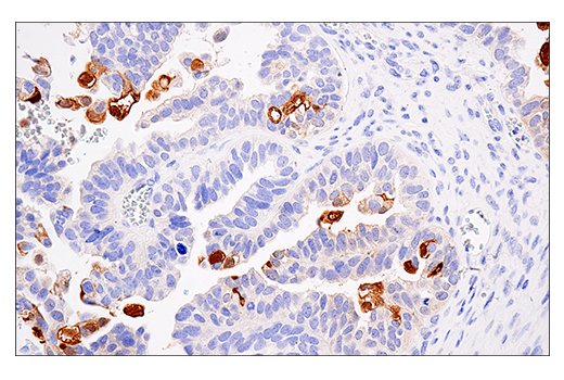 Immunohistochemistry Image 1: S100A7 (E7X2C) Rabbit mAb