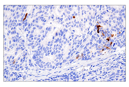 Immunohistochemistry Image 2: S100A7 (E7X2C) Rabbit mAb