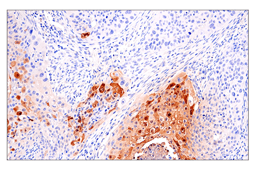 Immunohistochemistry Image 4: S100A7 (E7X2C) Rabbit mAb