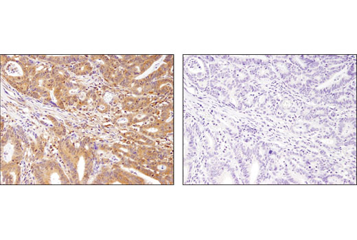 Immunohistochemistry Image 1: MEK1 (D2R1O) Rabbit mAb (BSA and Azide Free)