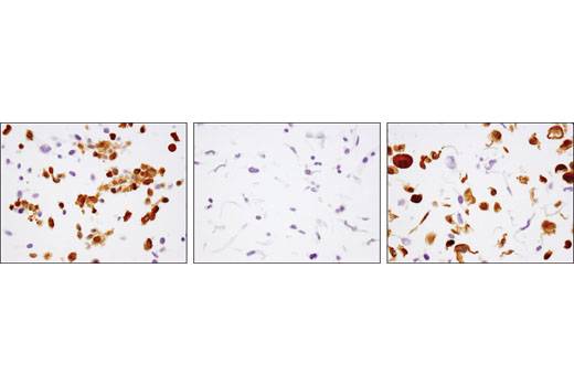 Immunohistochemistry Image 2: MEK1 (D2R1O) Rabbit mAb (BSA and Azide Free)
