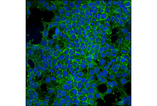 Immunofluorescence Image 1: Notch2 (D67C8) XP® Rabbit mAb