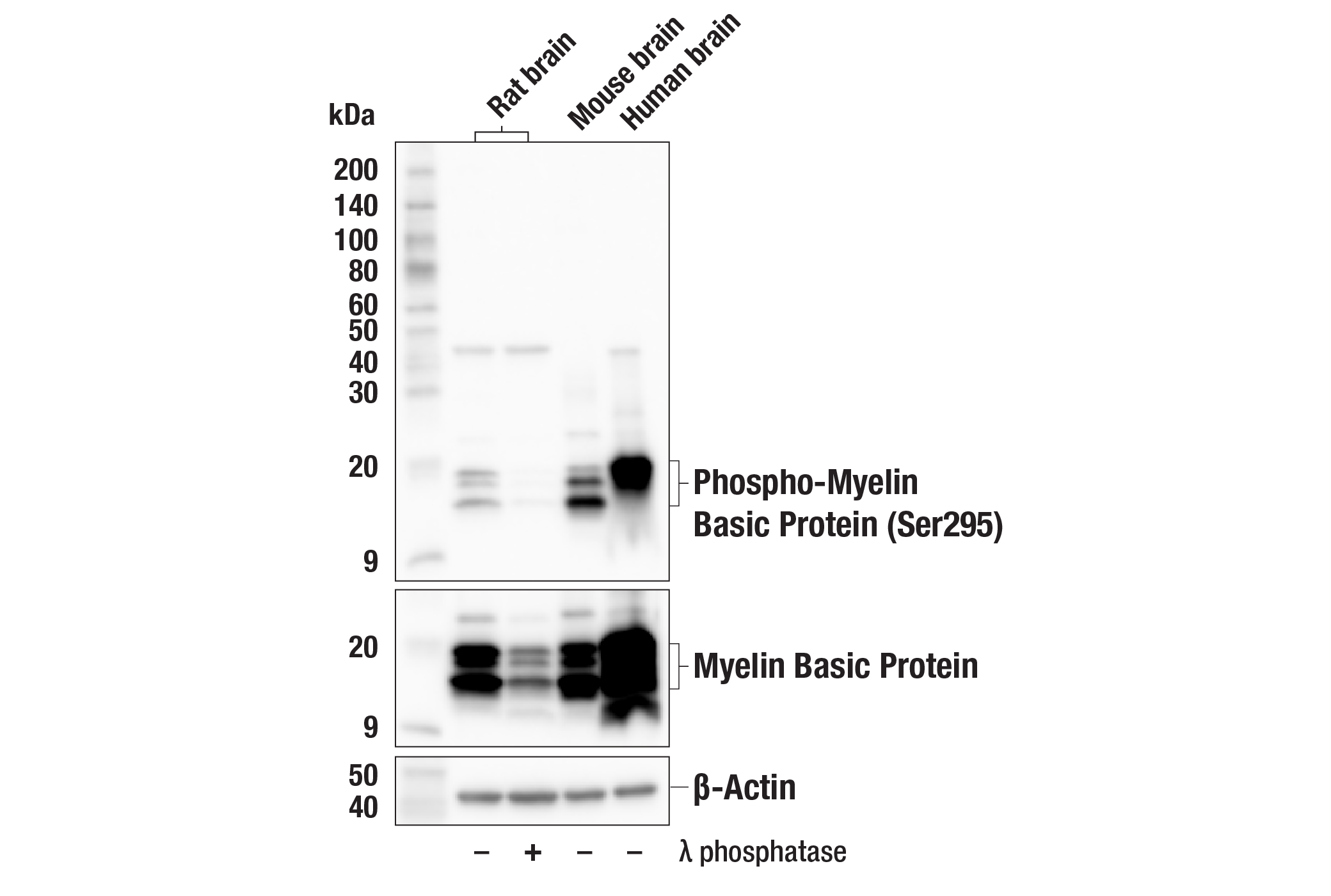 Western Blotting Image 1: Phospho-Myelin Basic Protein (Ser295) Antibody