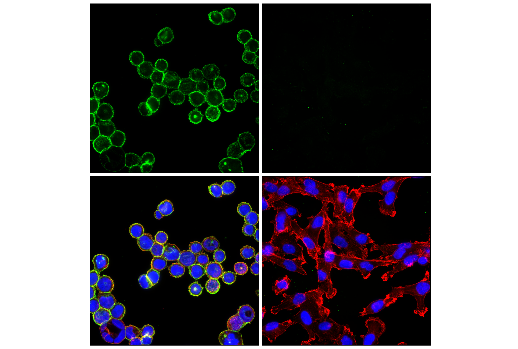 Immunofluorescence Image 1: HER2/ErbB2 (29D8) Rabbit mAb (Alexa Fluor® 488 Conjugate)