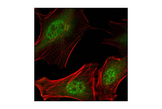 Immunofluorescence Image 1: Daxx (25C12) Rabbit mAb