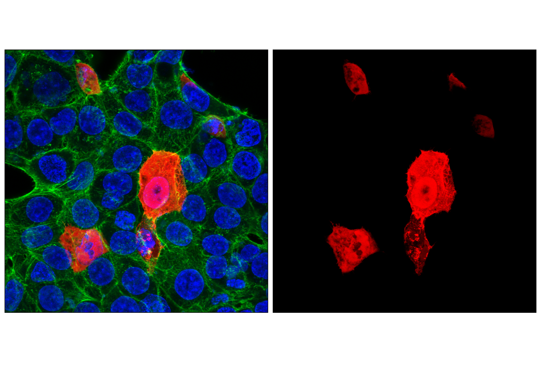 Immunofluorescence Image 1: HA-Tag (C29F4) Rabbit mAb (Alexa Fluor® 594 Conjugate)