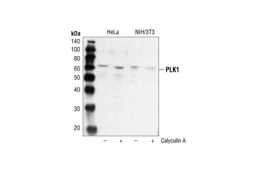Western Blotting Image 1: PLK1 Antibody