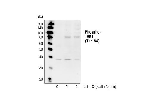 Western Blotting Image 1: Phospho-TAK1 (Thr184) Antibody