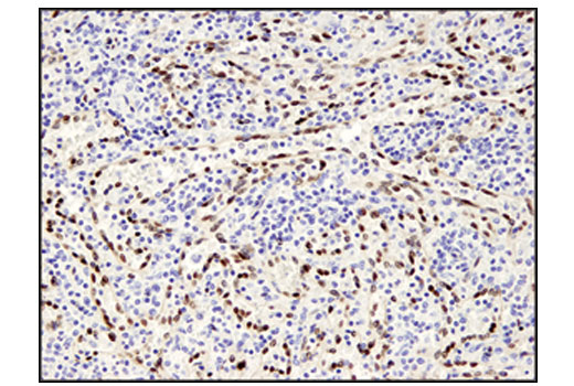 Immunohistochemistry Image 3: ERG (A7L1G) Rabbit mAb (BSA and Azide Free)