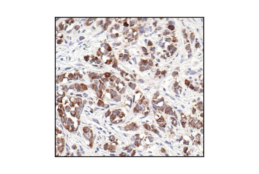 Immunohistochemistry Image 1: MUC1 (VU4H5) Mouse mAb