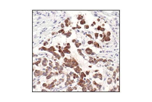 Immunohistochemistry Image 2: MUC1 (VU4H5) Mouse mAb (BSA and Azide Free)