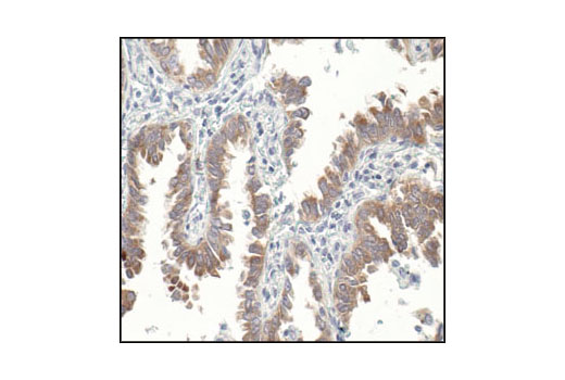 Immunohistochemistry Image 3: MUC1 (VU4H5) Mouse mAb