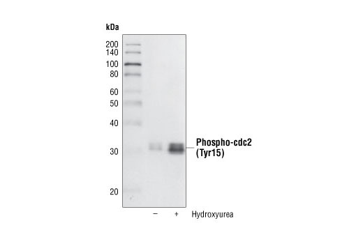  Image 11: Cell Cycle/Checkpoint Antibody Sampler Kit