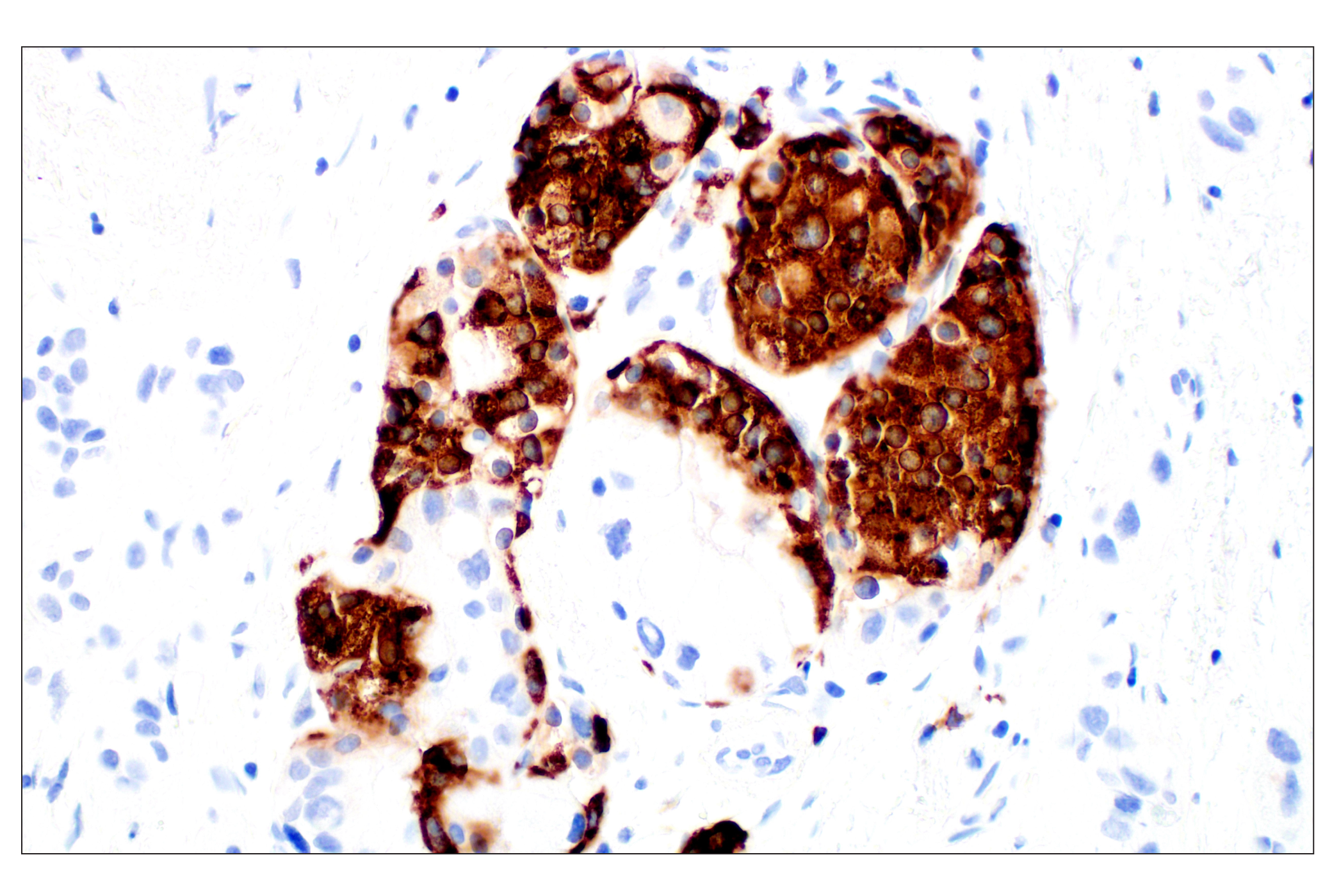 Immunohistochemistry Image 4: C-Peptide (E7U7F) XP® Rabbit mAb (BSA and Azide Free)