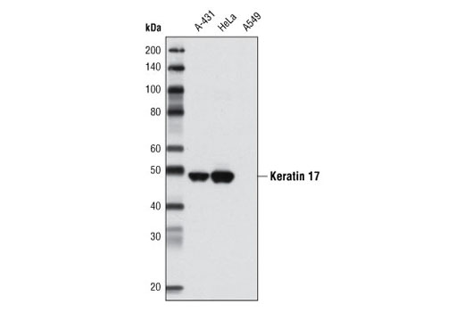 Western Blotting Image 1: Keratin 17 (D73C7) Rabbit mAb