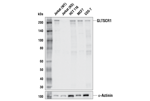  Image 3: Non-Canonical BAF Complex Antibody Sampler Kit