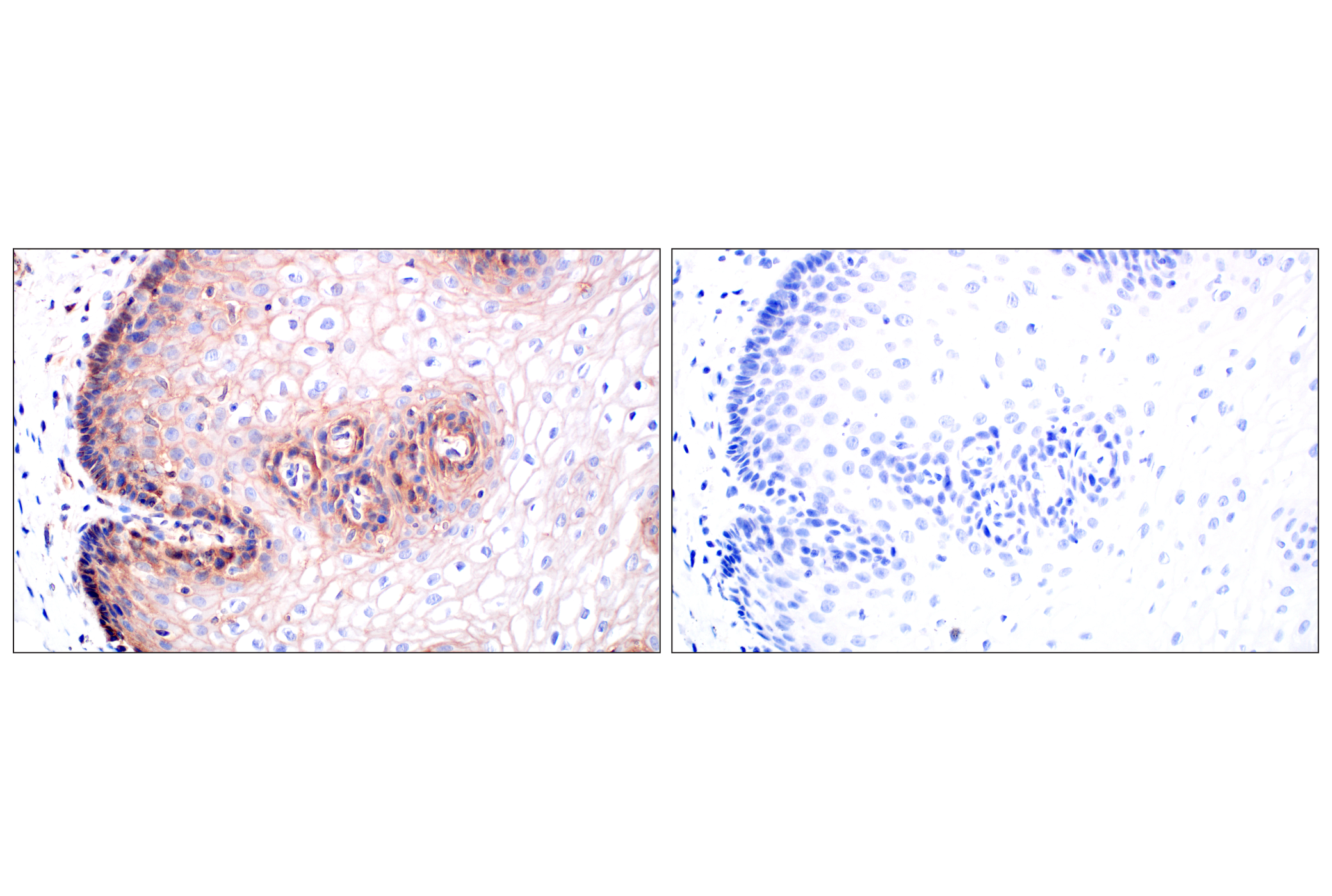 Immunohistochemistry Image 10: CD58 (F1C9B) Rabbit mAb
