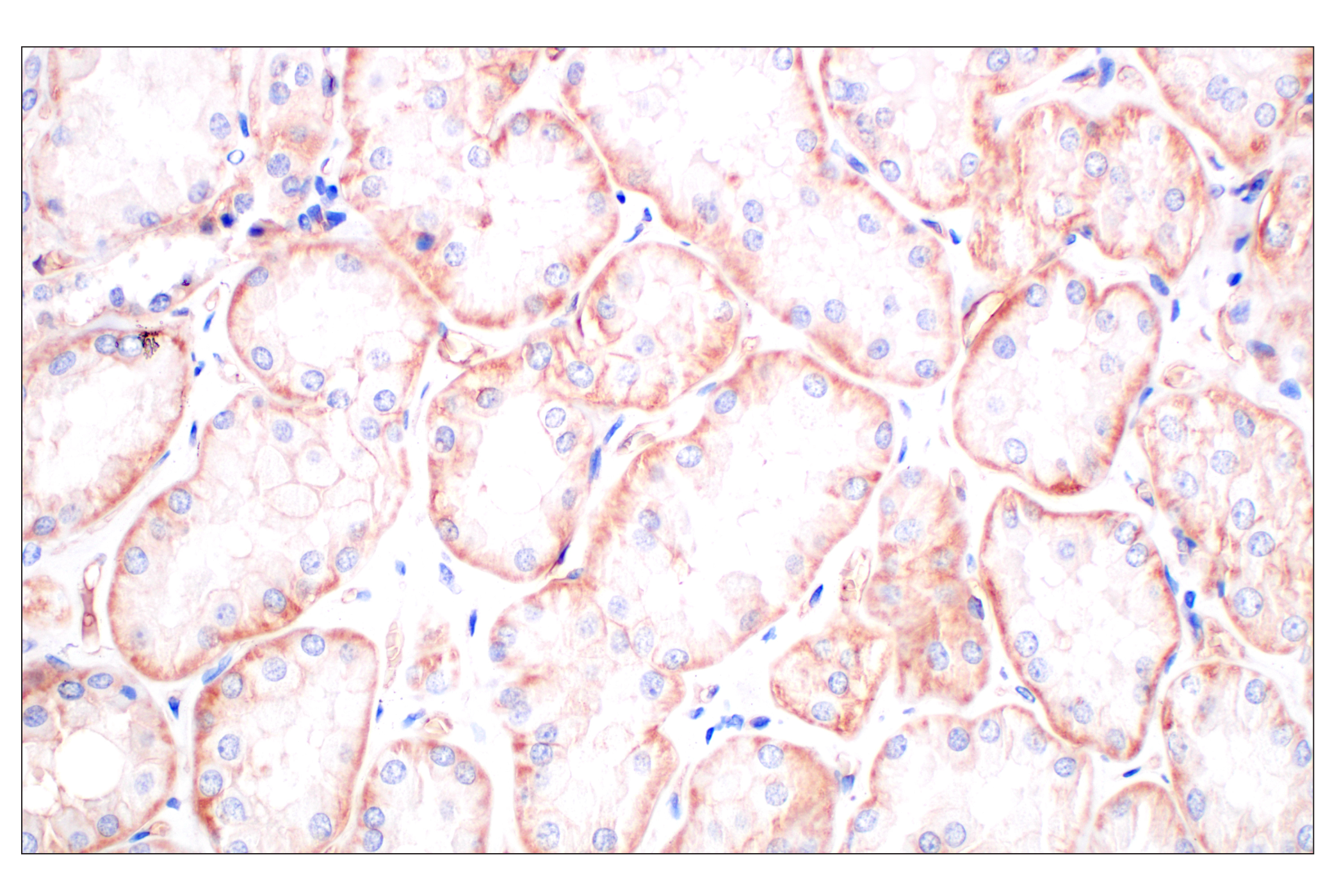 Immunohistochemistry Image 7: CD58 (F1C9B) Rabbit mAb