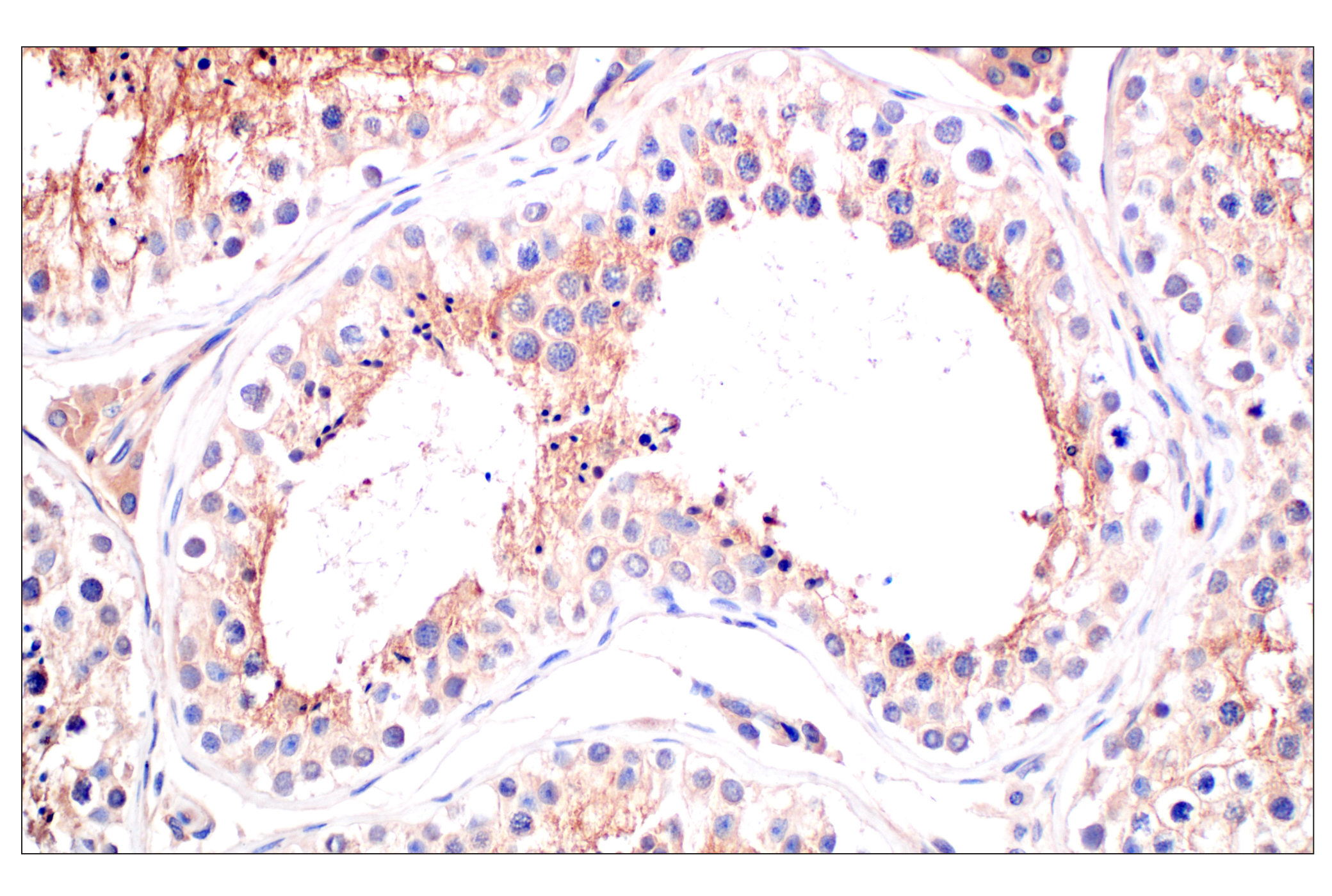 Immunohistochemistry Image 8: CD58 (F1C9B) Rabbit mAb