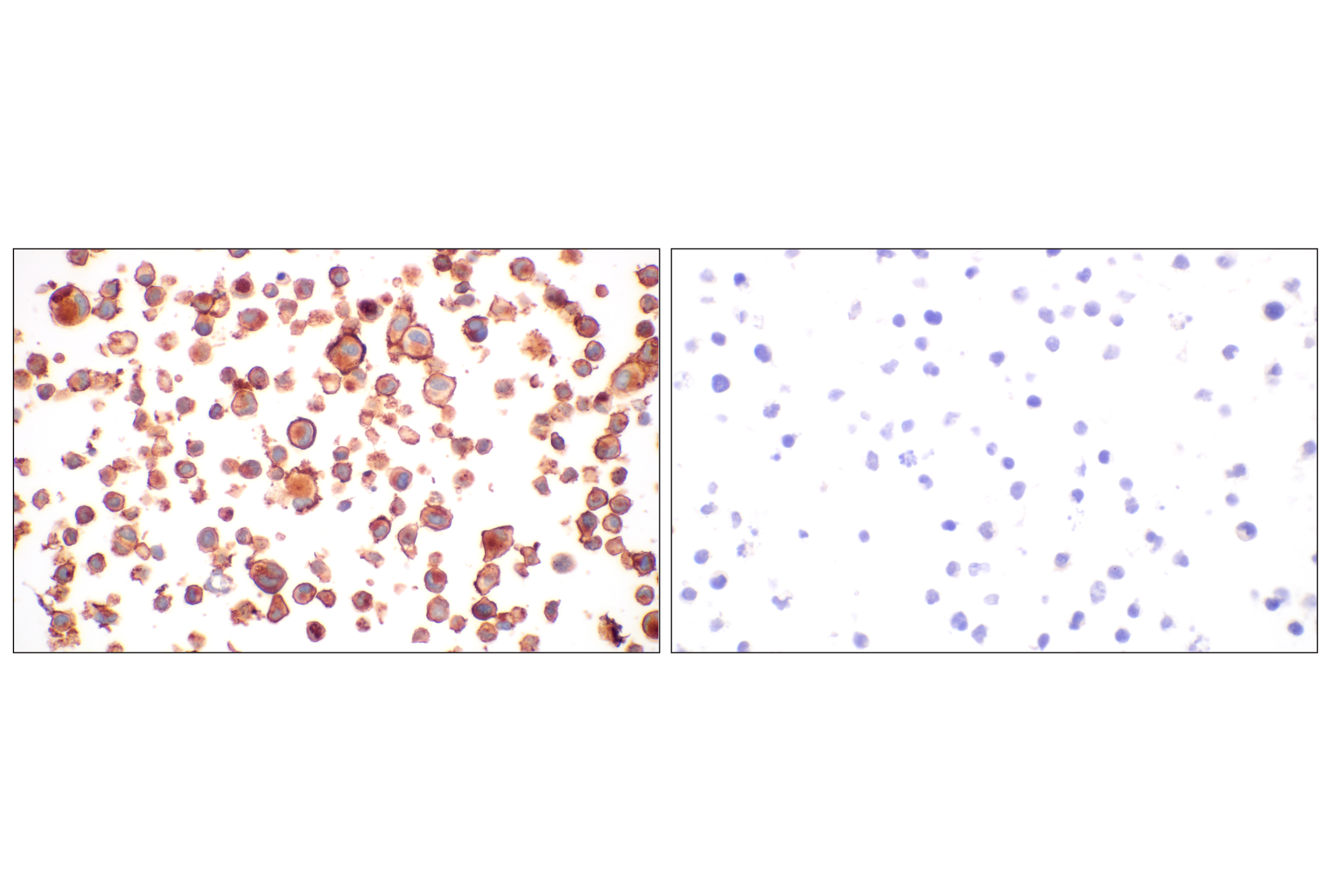 Immunohistochemistry Image 11: CD58 (F1C9B) Rabbit mAb