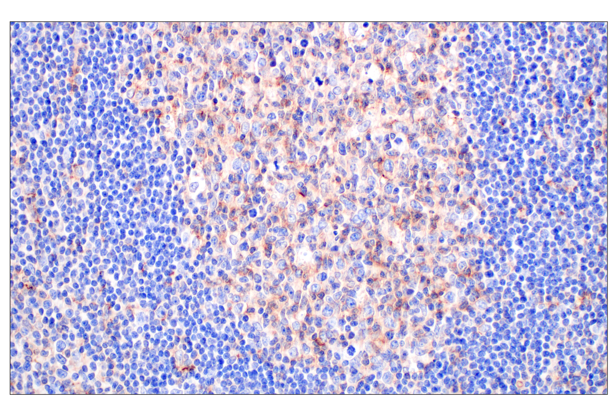 Immunohistochemistry Image 9: CD58 (F1C9B) Rabbit mAb