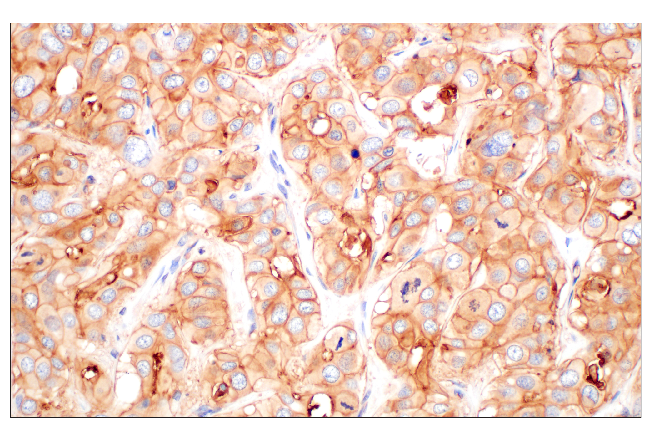 Immunohistochemistry Image 2: CD58 (F1C9B) Rabbit mAb