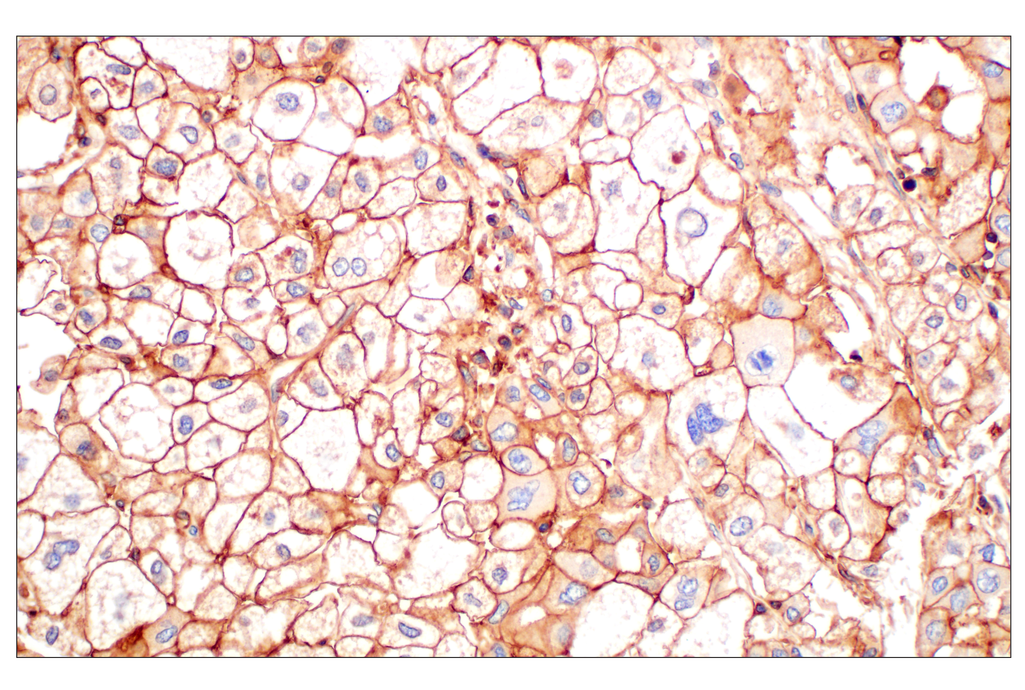 Immunohistochemistry Image 4: CD58 (F1C9B) Rabbit mAb