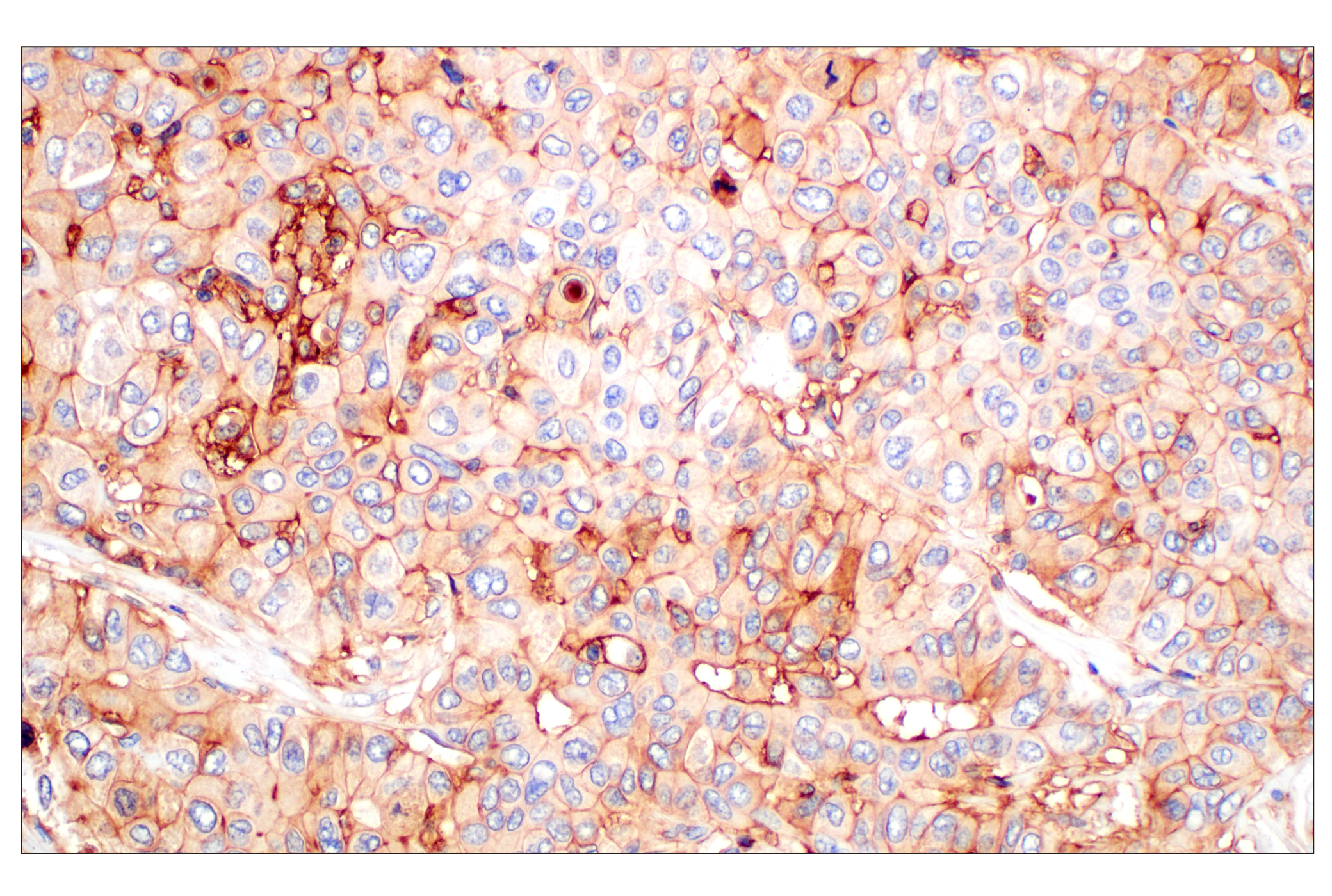 Immunohistochemistry Image 1: CD58 (F1C9B) Rabbit mAb