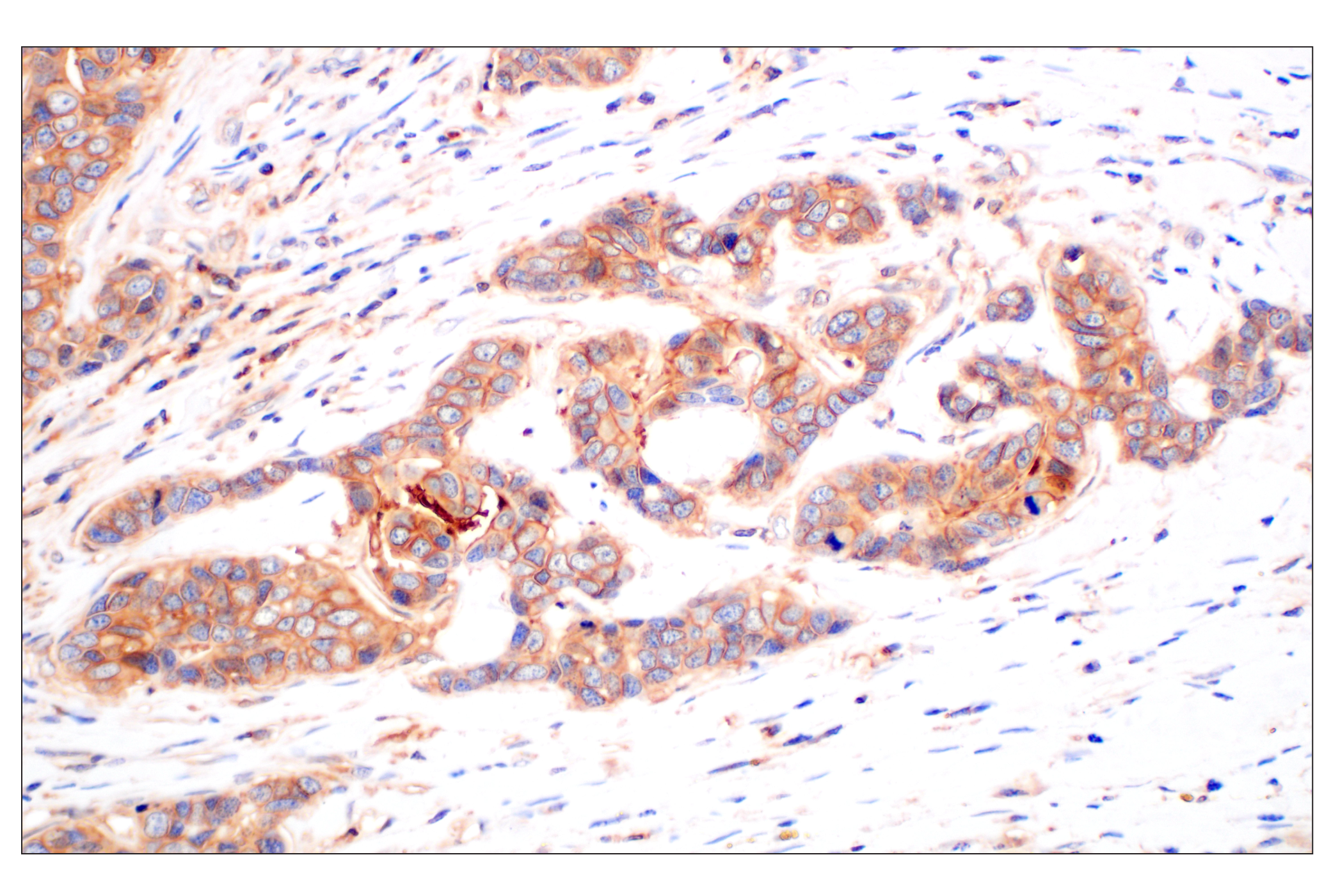 Immunohistochemistry Image 5: CD58 (F1C9B) Rabbit mAb