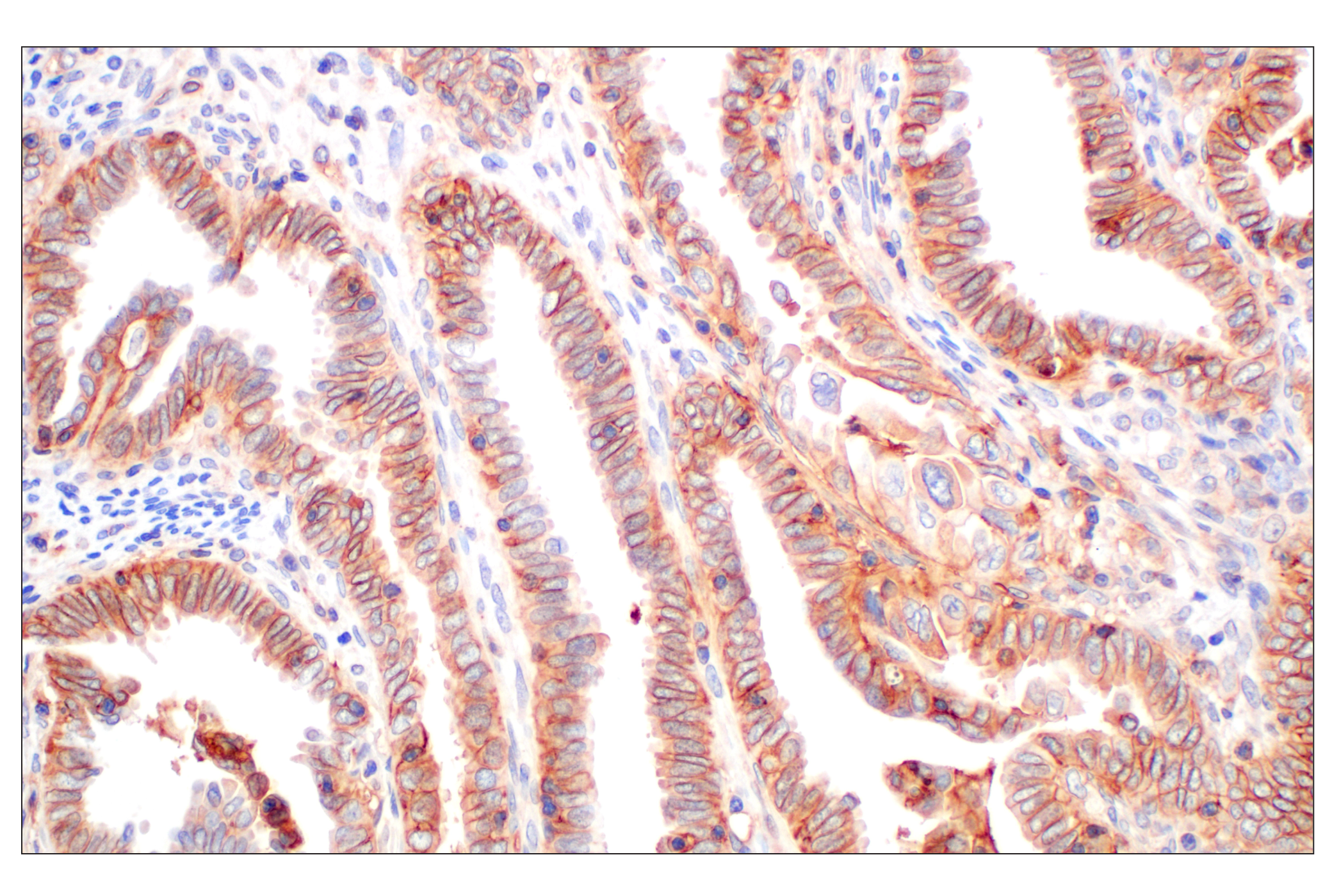 Immunohistochemistry Image 3: CD58 (F1C9B) Rabbit mAb