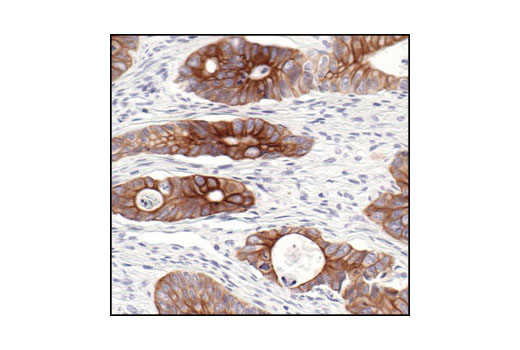 Immunohistochemistry Image 2: Keratin 8/18 (C51) Mouse mAb