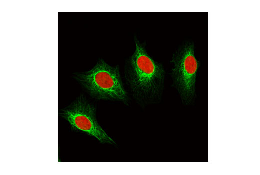 Immunofluorescence Image 1: Keratin 8/18 (C51) Mouse mAb