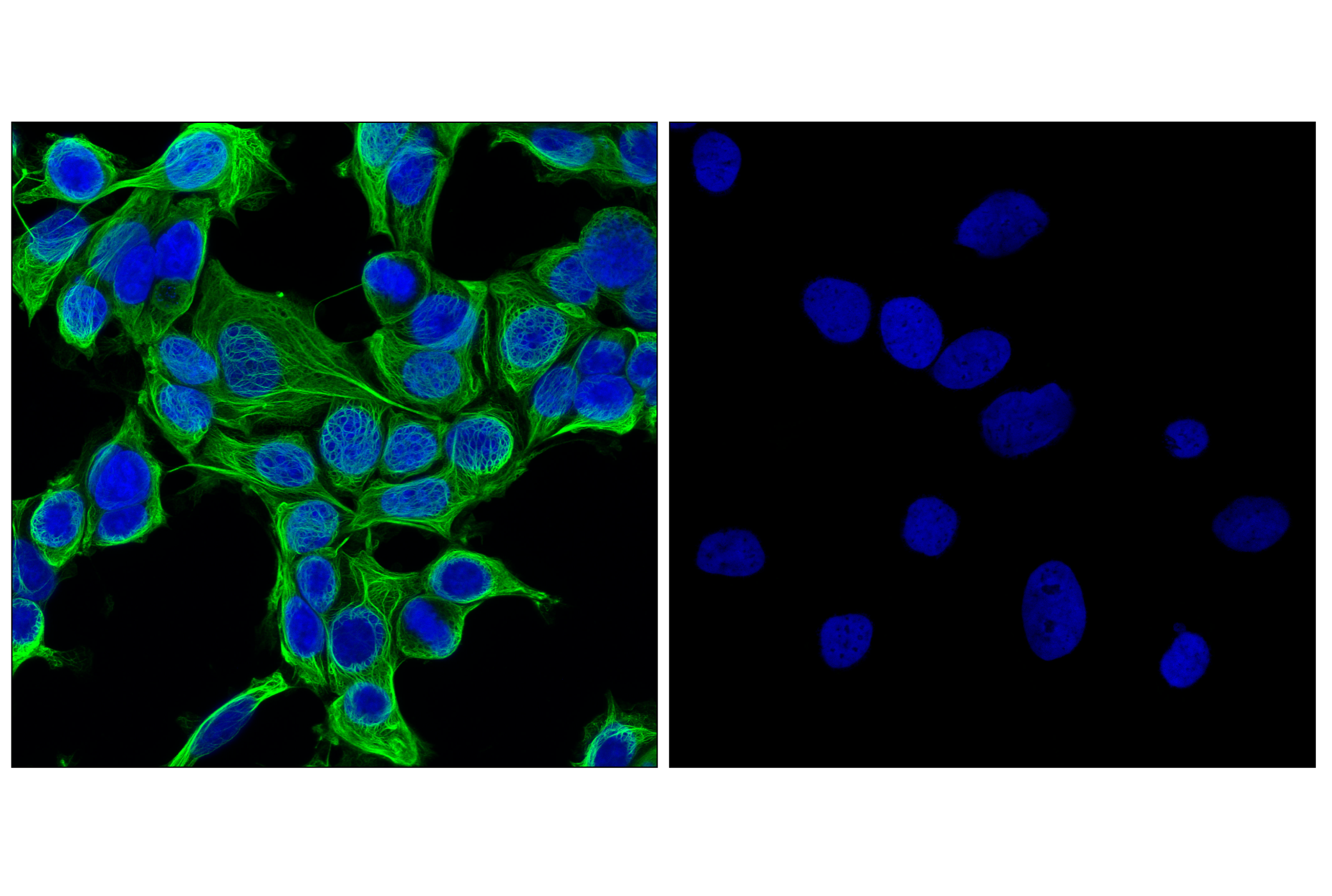  Image 1: Cytokeratin Antibody Sampler Kit