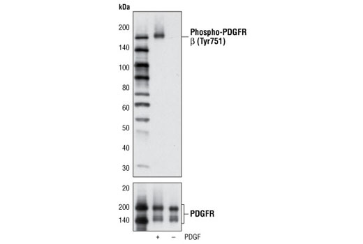  Image 6: PDGF Receptor β Antibody Sampler Kit