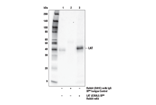 Immunoprecipitation Image 1: LAT (E3U6J) XP® Rabbit mAb