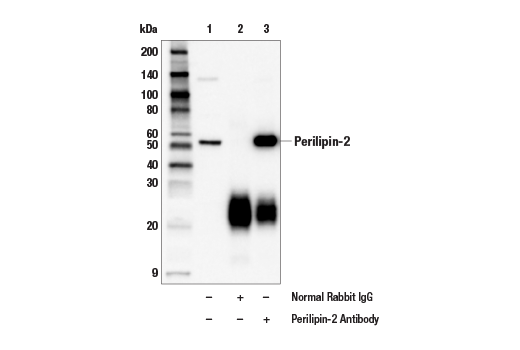 Immunoprecipitation Image 1: Perilipin-2 Antibody