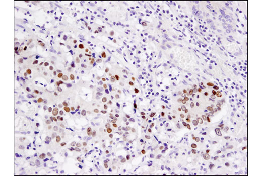 Immunohistochemistry Image 1: PROX1 (D2J6J) Rabbit mAb (BSA and Azide Free)