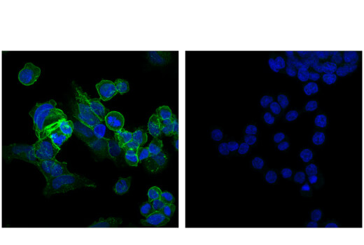 Immunofluorescence Image 1: ROBO2 (E4M6D) Rabbit mAb
