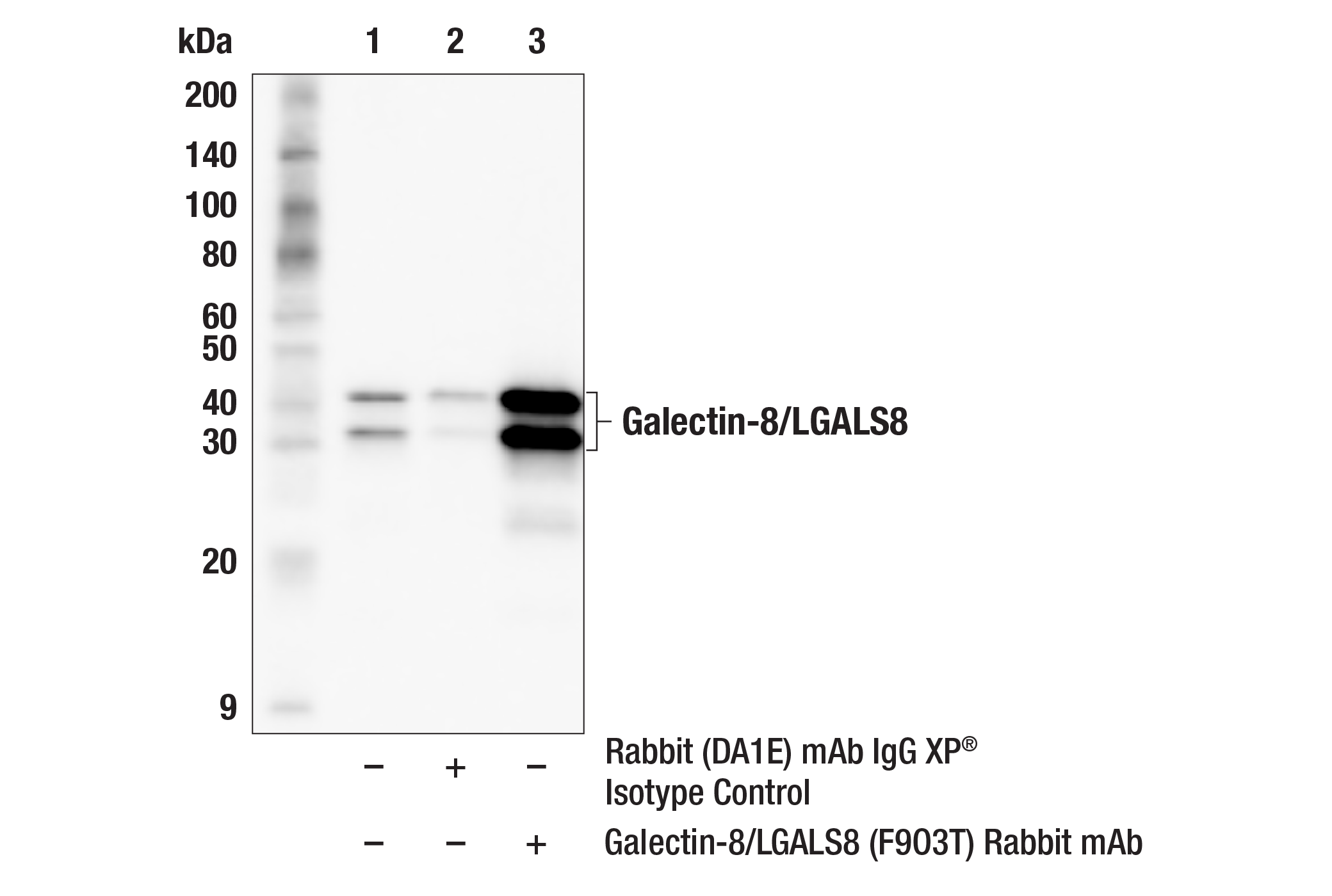 Immunoprecipitation Image 1: Galectin-8/LGALS8 (F9O3T) Rabbit mAb