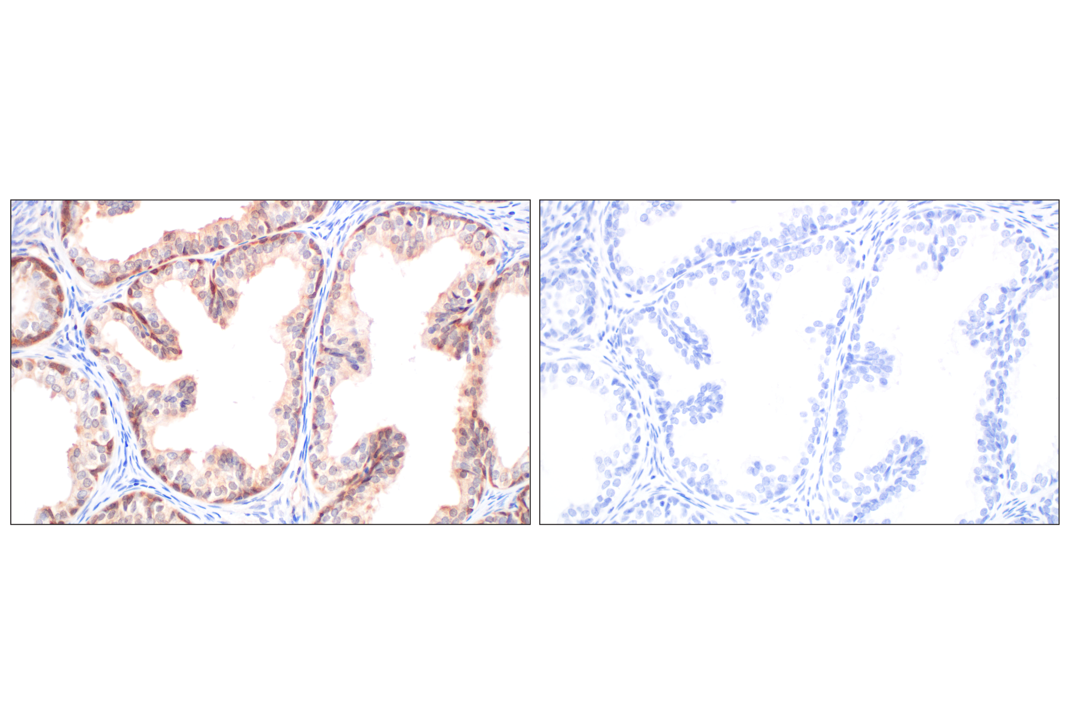 Immunohistochemistry Image 11: Galectin-8/LGALS8 (F9O3T) Rabbit mAb