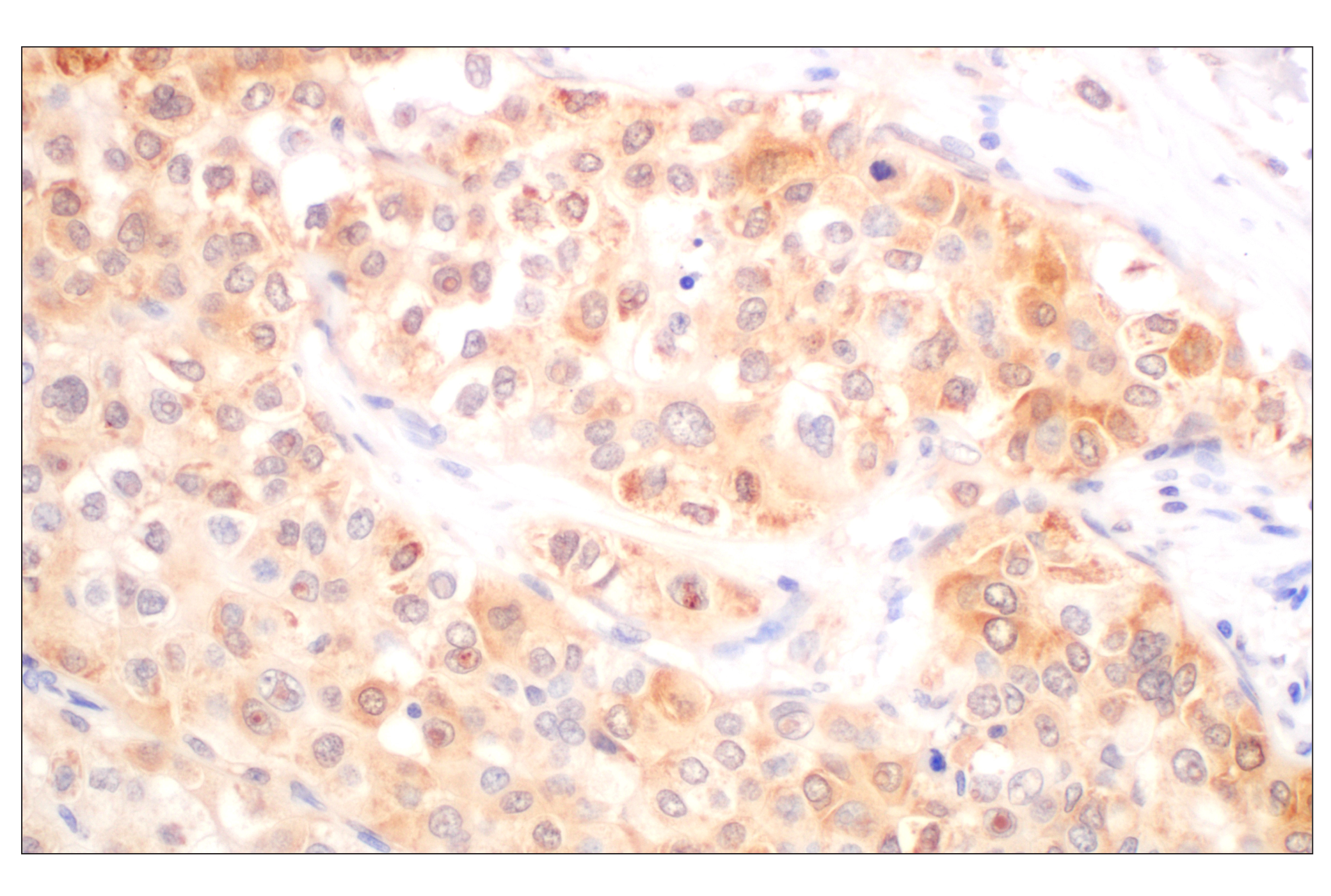 Immunohistochemistry Image 5: Galectin-8/LGALS8 (F9O3T) Rabbit mAb